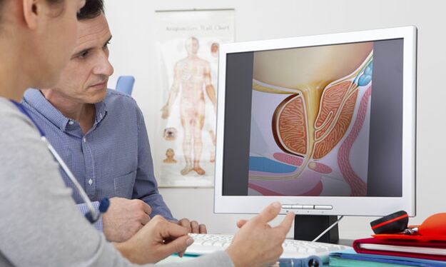 Suchen Sie einen Arzt auf, wenn ein pathologischer Ausfluss aus dem Penis vorliegt.